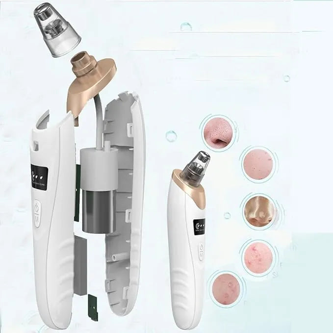 Beauty Electric Blackhead Remover Facial