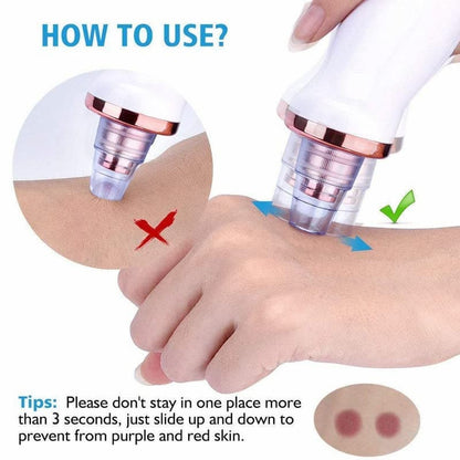 ⭐ DermaGlow 5-in-1 Blackhead Vacuum Pore Cleaner